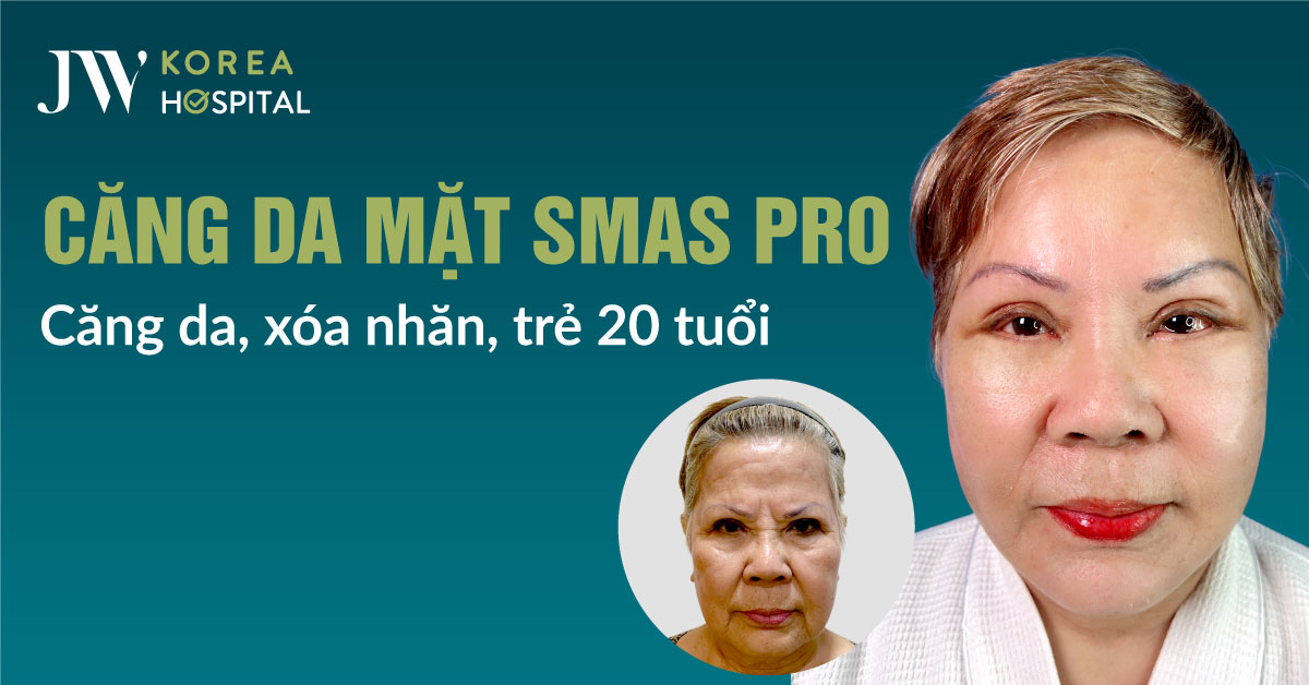Căng da mặt SMAS Pro tại Bệnh viện JW là giải pháp phù hợp cho khách hàng trung niên có da chảy xệ nhiều