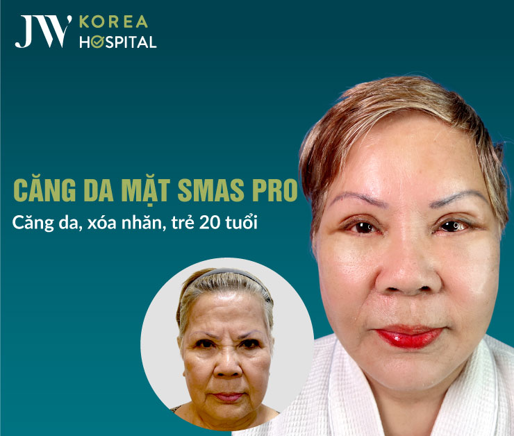 Căng da mặt SMAS Pro tại Bệnh viện JW giúp cải thiện da chảy xệ, nâng cơ rõ rệt