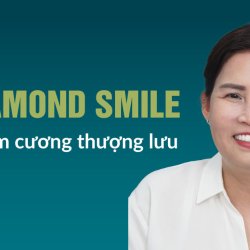 Răng sứ kim cương JW Diamond Smile – Nụ cười đẹp tinh tế chuẩn giới thượng lưu