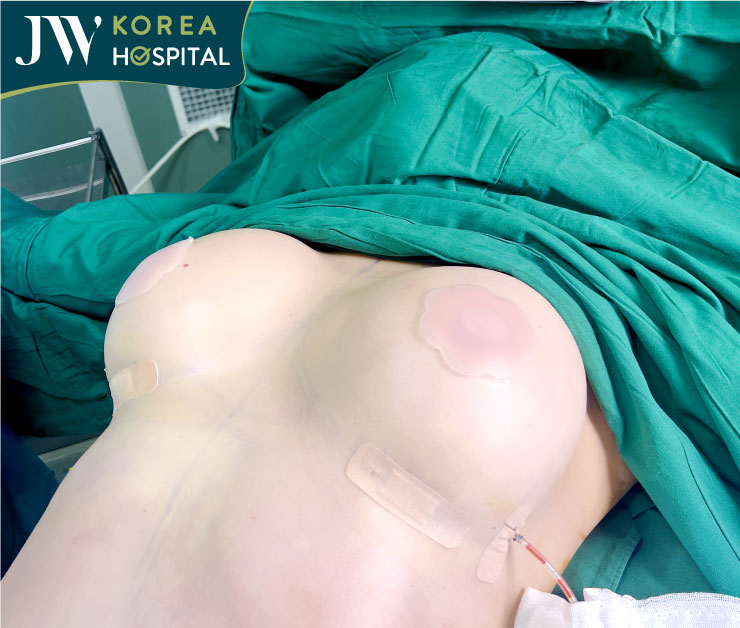 Ngực căng tròn, thay đổi rõ rệt ngay trên bàn mổ