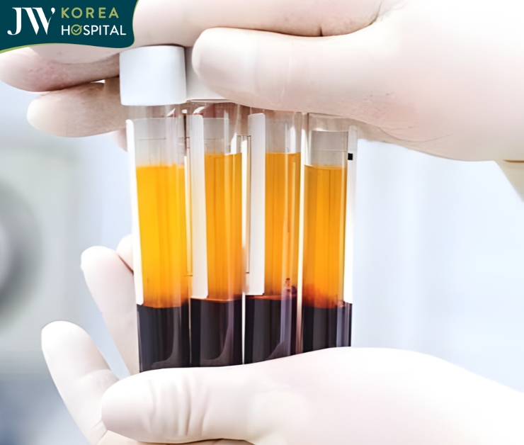 Mỡ tự thân được lấy từ chính cơ thể khách hàng và được quay li tâm an toàn đạt chuẩn y khoa