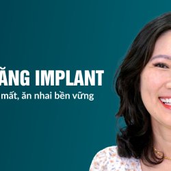 Trồng răng Implant tức thì tại JW – Phục hồi răng mất, ăn nhai bền vững