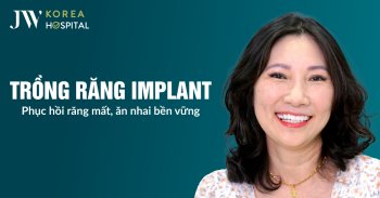 Trồng răng Implant tức thì tại JW – Phục hồi răng mất, ăn nhai bền vững