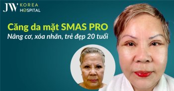 Căng da mặt SMAS Pro tại JW – Trẻ hóa toàn diện, giữ nét tự nhiên
