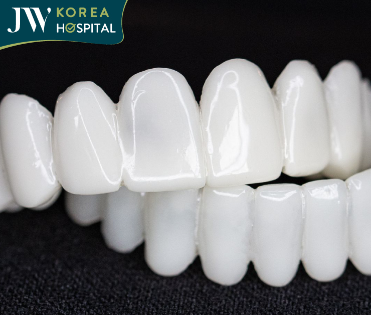 Răng sứ kim cương JW Diamond Smile được VBI Smile Care VietinBank chứng nhận chất lượng và an toàn