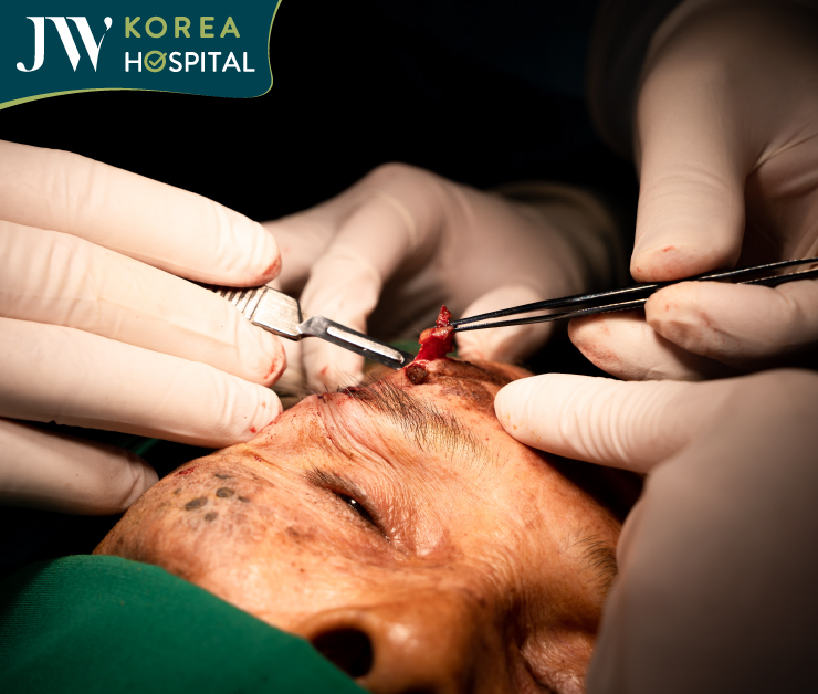 Cận cảnh quá trình cắt bỏ khối u chân mày cho cụ bà 90 tuổi tại Bệnh viện JW 