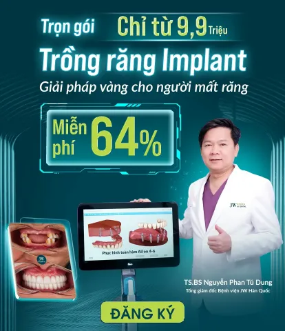 Trồng răng Implant 2026