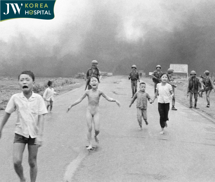 Bức tranh Em bé Napalm gây chấn động toàn cầu