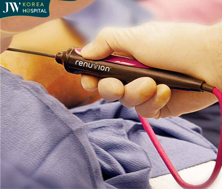 Kĩ thuật thực hiện công nghệ J Plasma