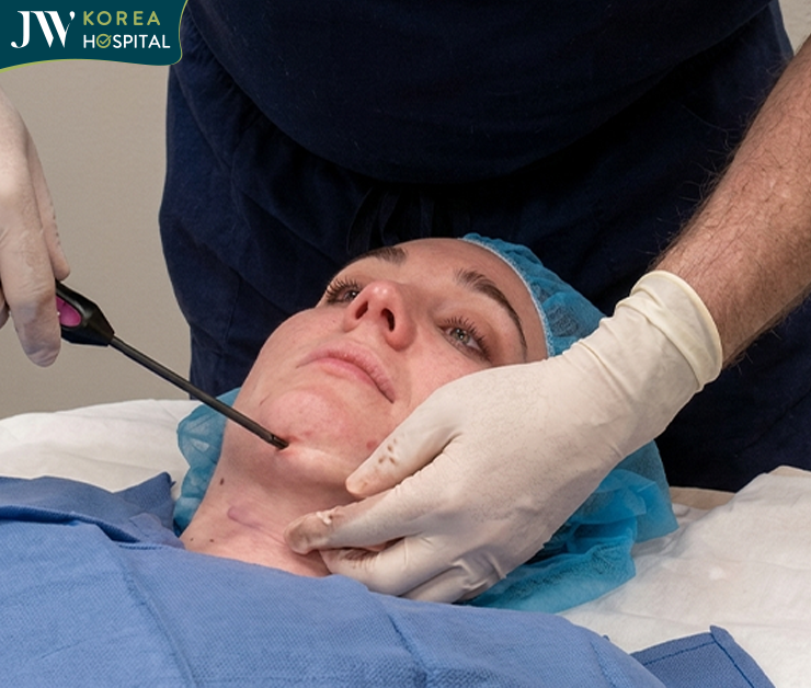 căng da mặt và cổ j plasma