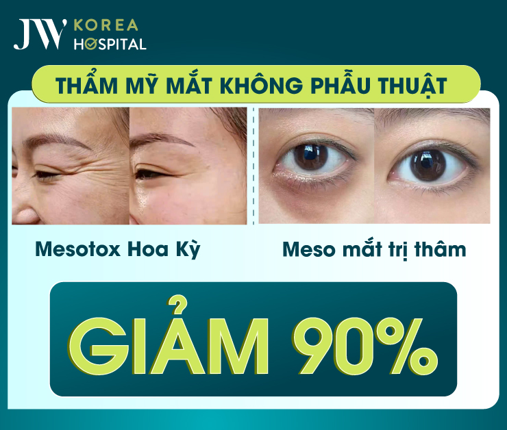 Thẩm mỹ không phẫu thuật tại Bệnh viện JW bao gồm Mesotox Hoa Kỳ và Meso mắt trị quầng thâm