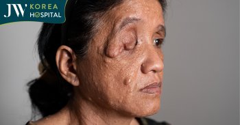 Người phụ nữ sống chung với đa u sợi thần kinh 50 năm được tìm lại ánh sáng tại JW