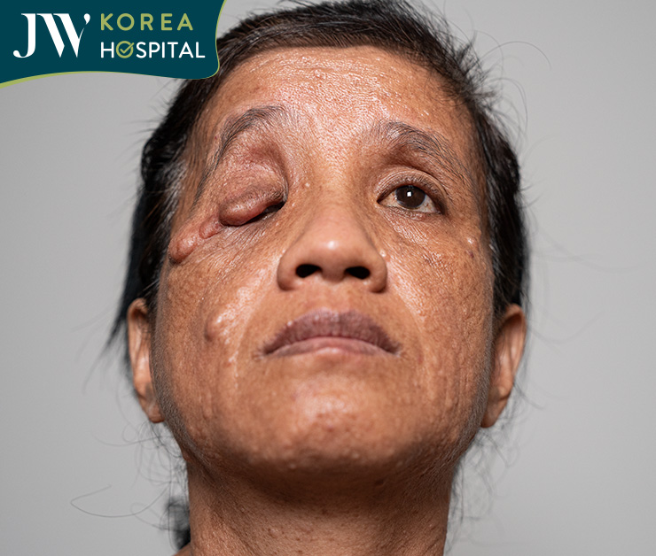 Cô Bé Phương được bệnh viện JW tiếp nhận điều trị sau khi nhiều nơi từ chối
