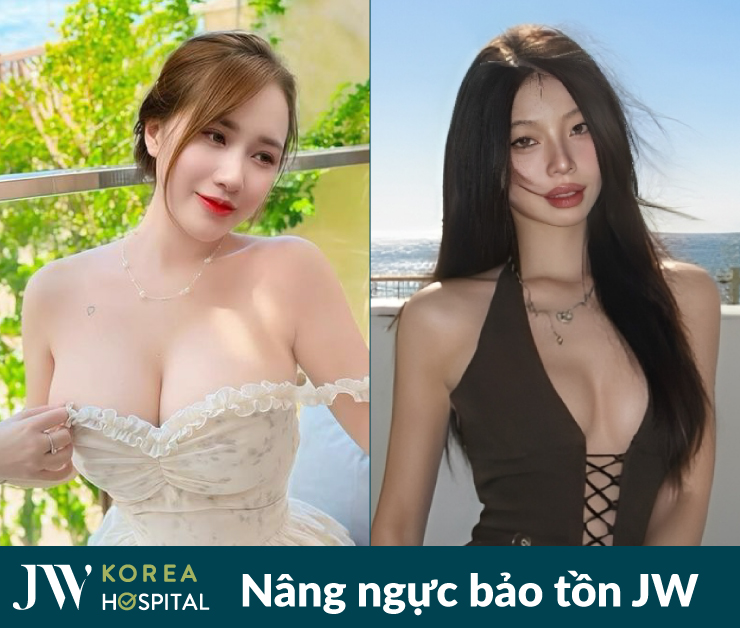Sở hữu vòng 1 quyễn rũ sau nâng ngực bảo tồn tại bệnh viện JW