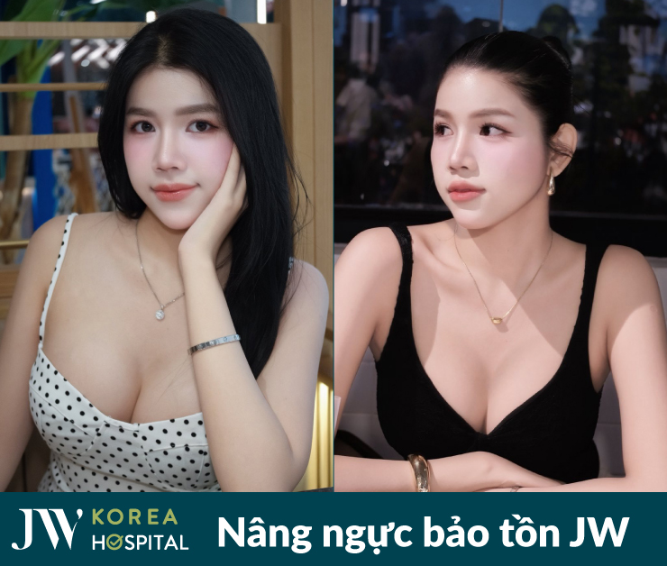999+ chị đẹp chọn nâng ngực bảo tồn tại bệnh viện JW