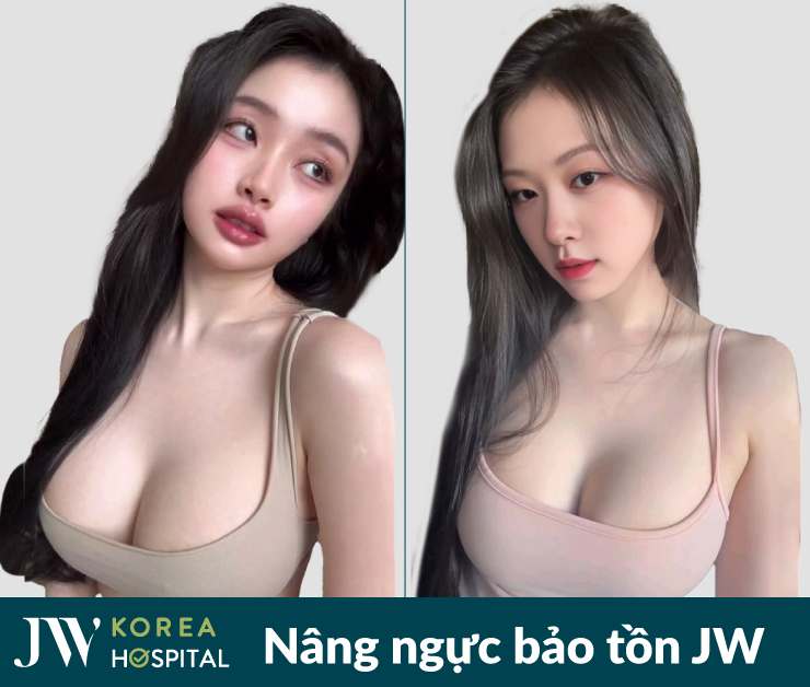 Vòng 1 căng tròn quyến rũ với nâng ngực bảo tồn tại Bệnh viện JW